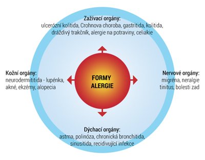 Léčba alergií | odvykání kouření, léčba alergií, redukce váhy
